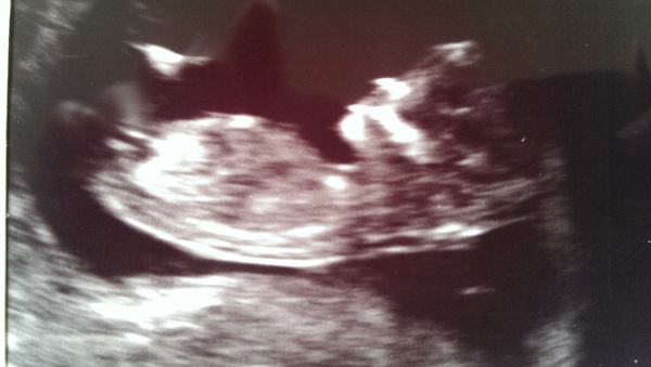 March Mummies 2015 - ever hopeful for the return of sanity and departure of sickness as we approach second tri!