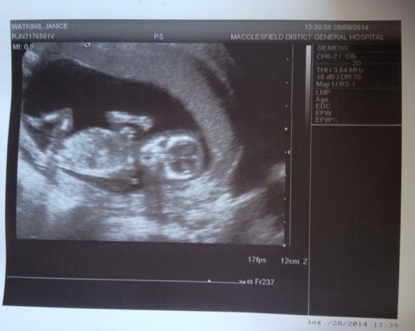 March Mummies 2015 - to second tri and beyond we go, bumps appearing and sickness (hopefully) disappearing