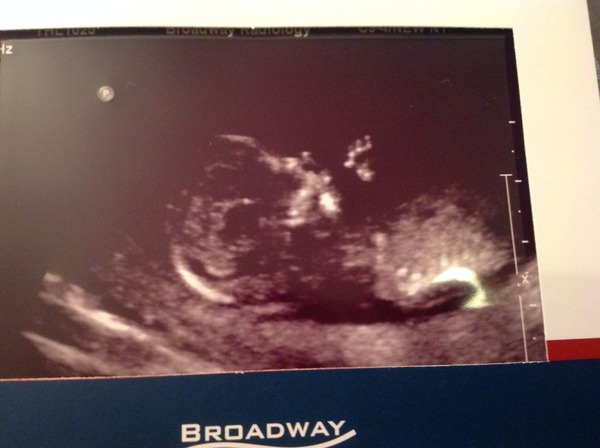 March Mummies 2015 - ever hopeful for the return of sanity and departure of sickness as we approach second tri!