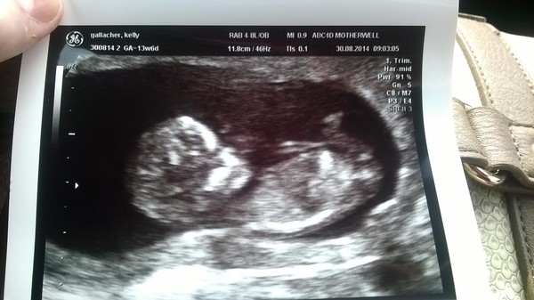 Scan Pic and How Far On...