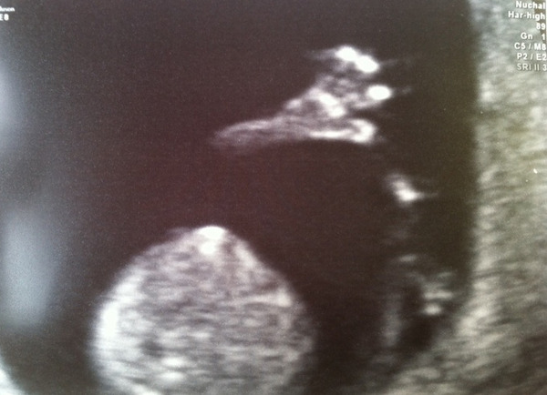 OVER HERE!!! Due April 2015