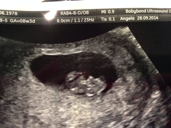 May 2015: Thread 2 - Let the sickness begin!