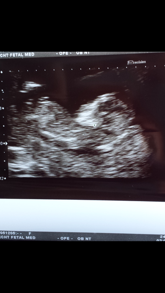 All that nub gender guessing nonsense. ..