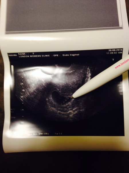 May 2015: Thread 2 - Let the sickness begin!