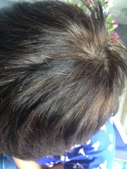 Hair dye help