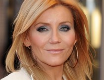 Amanda Holden Bad Botox