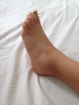 Sprained ankle (ds9) - should I get it checked