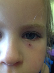 Any idea what this "spot" is near dd's eye? Pic attached.
