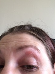 Eyebrow waxing nightmare