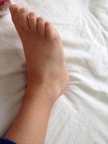 Sprained ankle (ds9) - should I get it checked