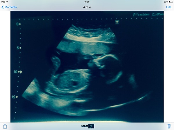 February 2015 #4 - Scans, glows, and shopping galore!