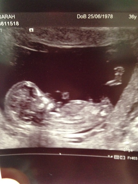 May 2015: Thread 3 - Let's do this :)