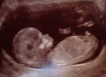 Nub guess? any ideas on gender?