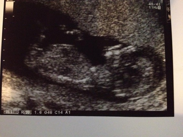 Tiptoeing into the Second Trimester... Due April 2015