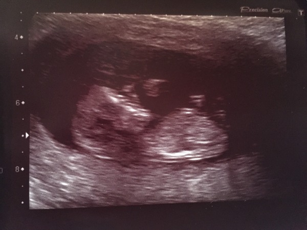 May 2015: Thread 3 - Let's do this :)