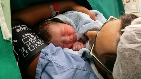 Gentle cesarean