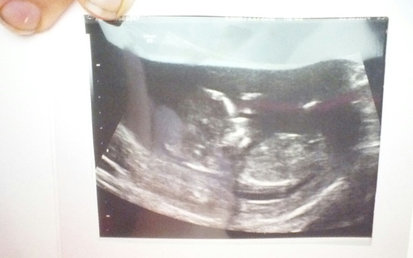 Tiptoeing into the Second Trimester... Due April 2015