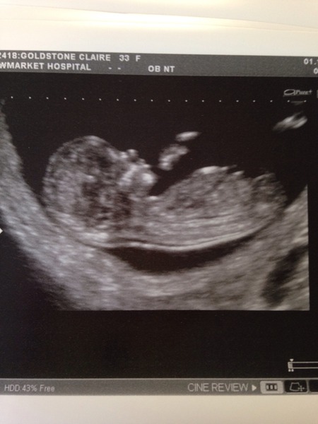 Tiptoeing into the Second Trimester... Due April 2015