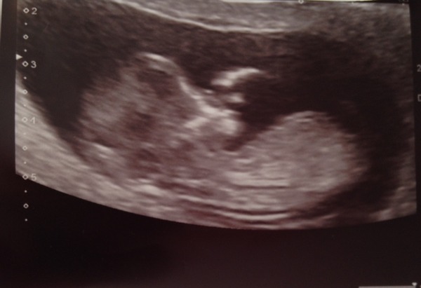 Tiptoeing into the Second Trimester... Due April 2015