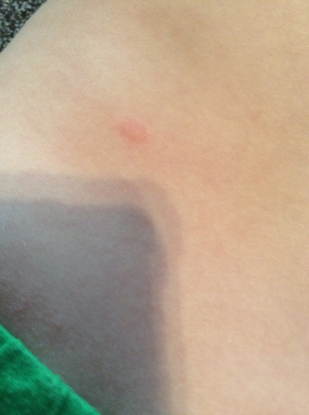Cold/cough symptoms with blister 3 year old