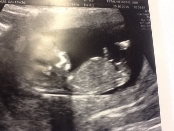 May 2015: Thread 3 - Let's do this :)