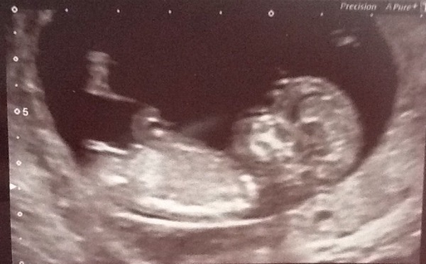 Tiptoeing into the Second Trimester... Due April 2015