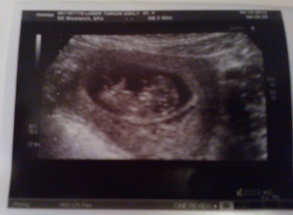 May 2015: Thread 2 - Let the sickness begin!