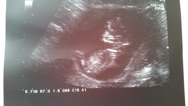 Tiptoeing into the Second Trimester... Due April 2015