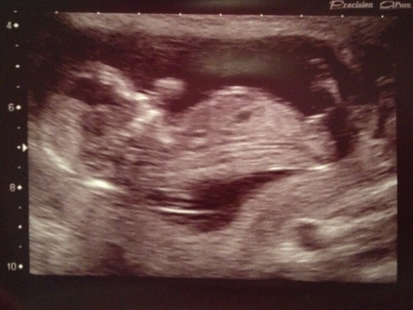 May 2015: Thread 3 - Let's do this :)