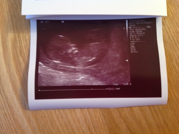 Tiptoeing into the Second Trimester... Due April 2015