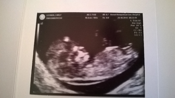 Taking the Plunge: Pregnancy thread