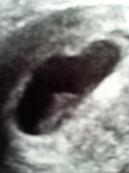 May 2015: Thread 3 - Let's do this :)