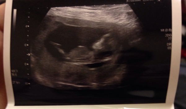 Yet another guess the gender thread!