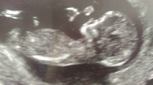 Tiptoeing into the Second Trimester... Due April 2015