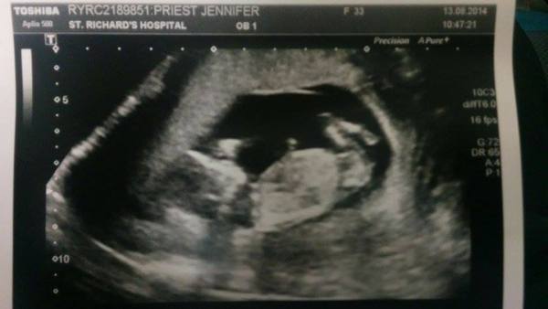 20 week Scan Monday, interested to see what people think the Gender is!