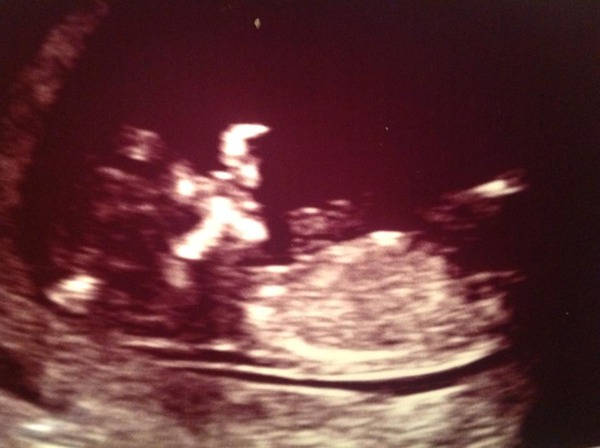 May 2015: Thread 3 - Let's do this :)