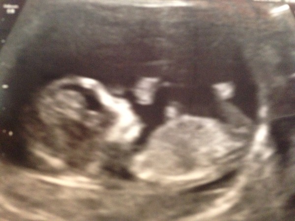 Tiptoeing into the Second Trimester... Due April 2015