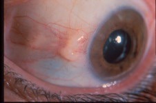 to ask about these weird lumps in my eyes and weird hairs on my bellybutton?