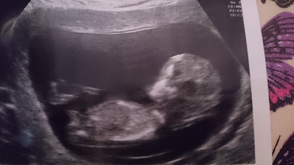 May 2015: Thread 3 - Let's do this :)