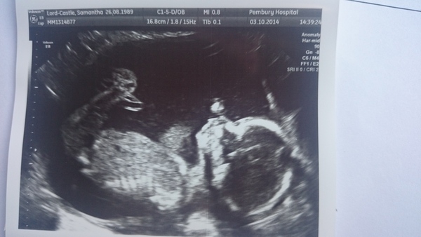 February 2015 #4 - Scans, glows, and shopping galore!