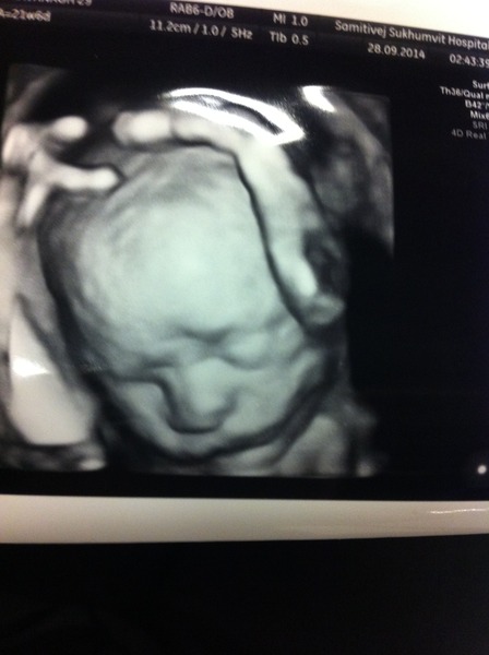 February 2015 #4 - Scans, glows, and shopping galore!