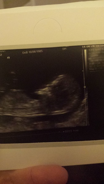 Tiptoeing into the Second Trimester... Due April 2015