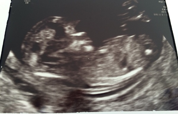 Taking the Plunge: Pregnancy thread