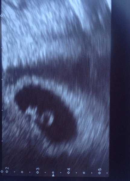 Maybe May, Maybe June 2015