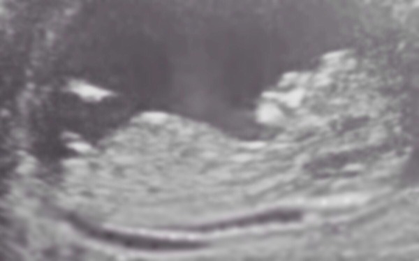 May 2015: Thread 3 - Let's do this :)