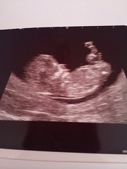 Tiptoeing into the Second Trimester... Due April 2015