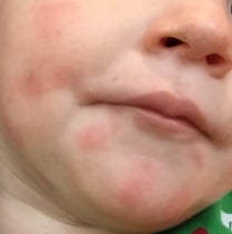 18mo face reacts when eating cheese