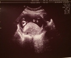 April 2015 #4 - time to start glowing and growing