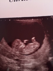 Tiptoeing into the Second Trimester... Due April 2015