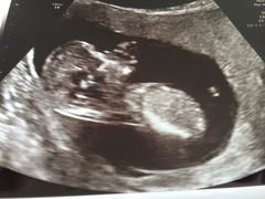 April TTC girls, the thread where everyone gets their BFP! :-)